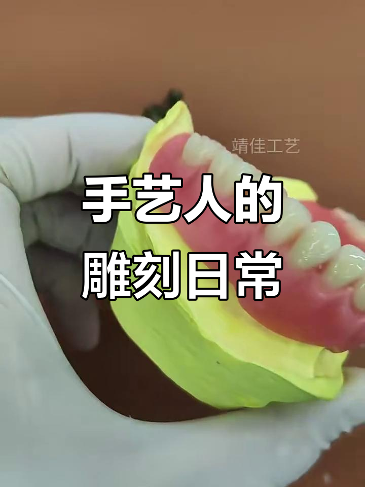 义齿雕蜡全过程揭秘,细节决定成败