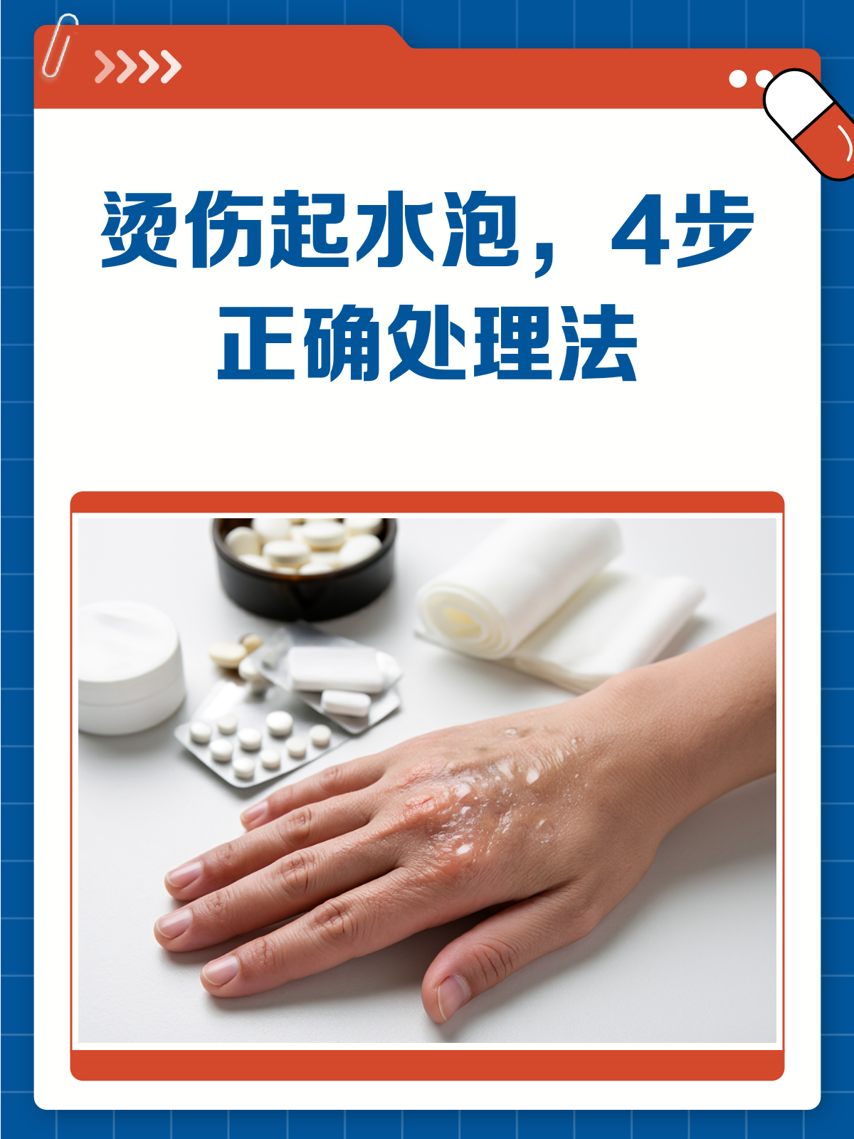 烫伤起水泡?别急,这样处理快又好!