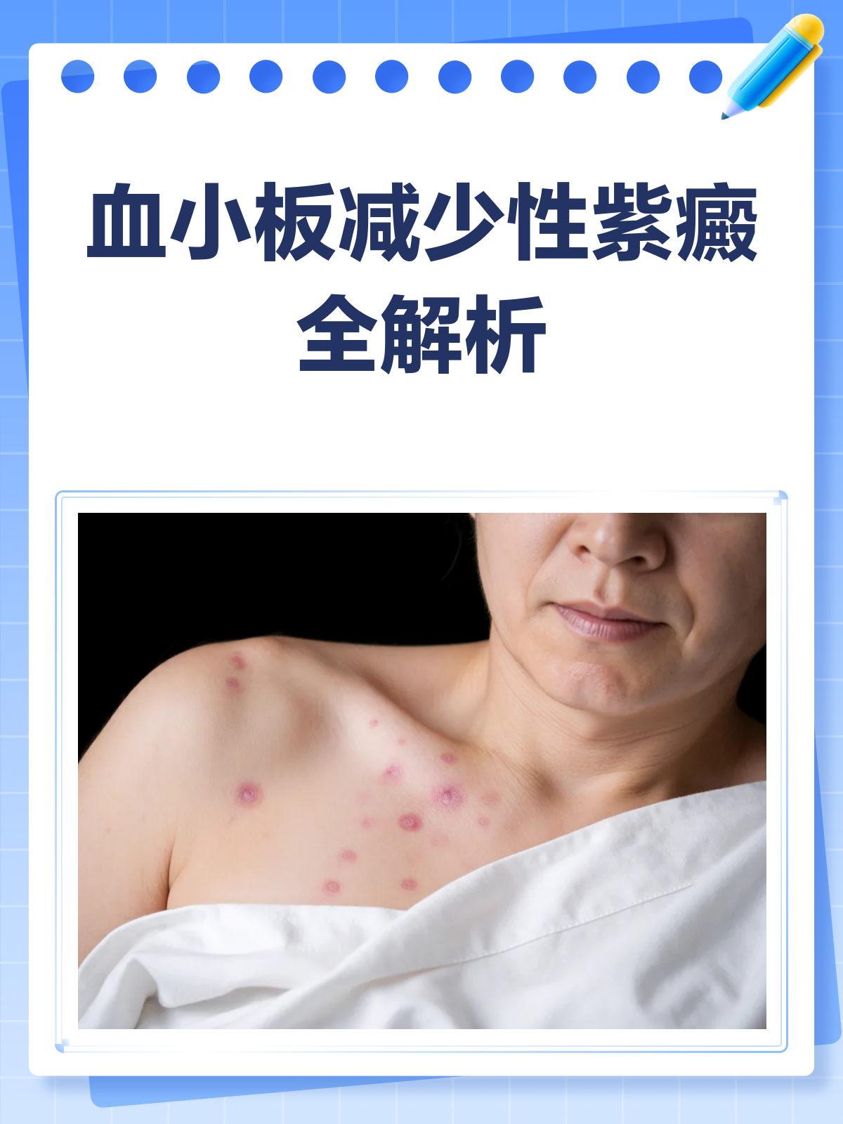 再生障碍性贫血治疗：最新进展与发展趋势