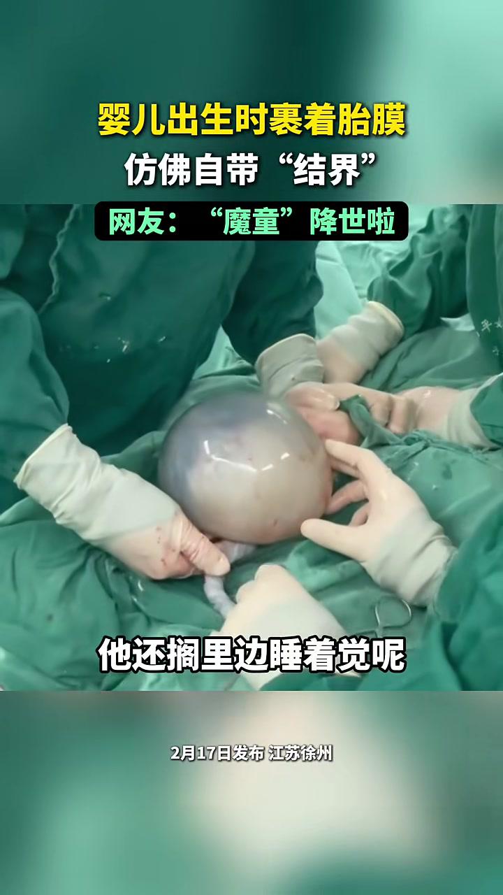 婴儿出生时裹着胎膜仿佛自带"结界",网友:现实版"魔童"降世啦!