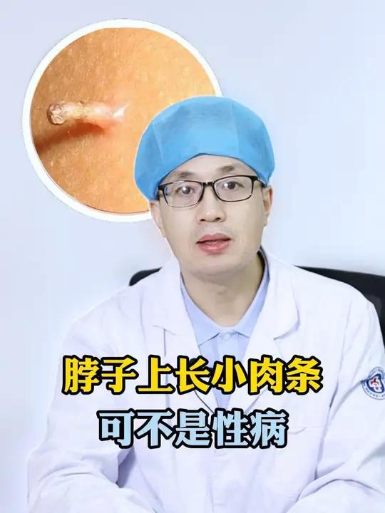 这种细长粗糙的小肉条,只是病毒感染引起的丝状疣,别担心