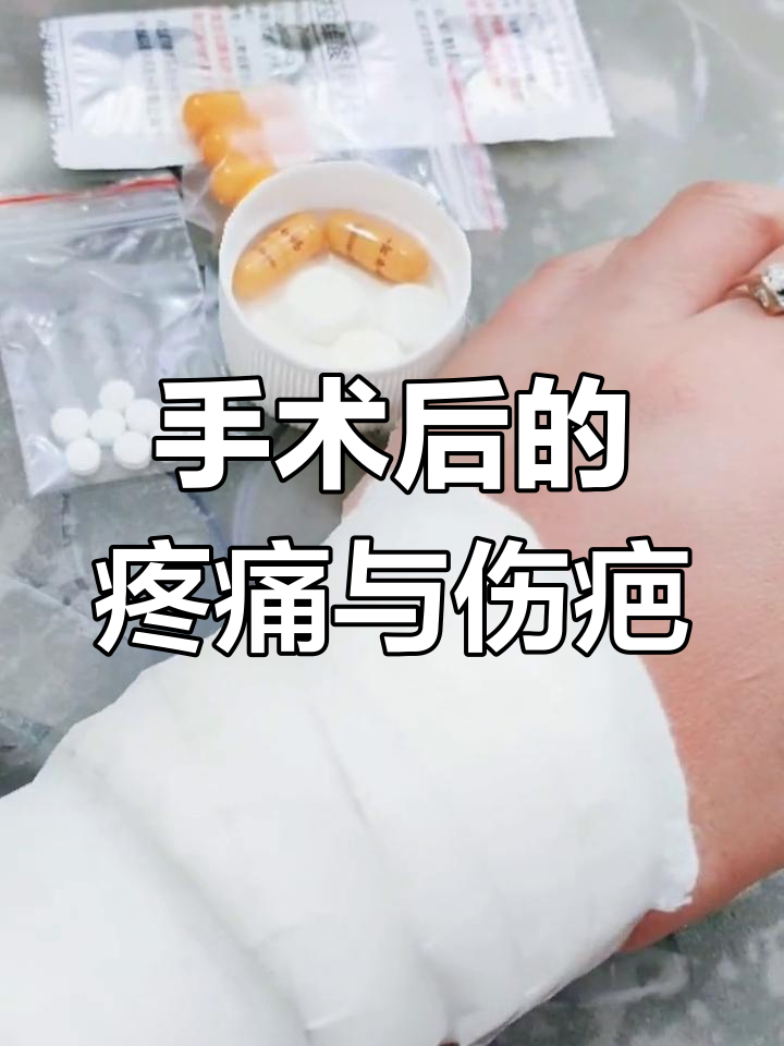 腱鞘囊肿手术后,手背留下疤痕