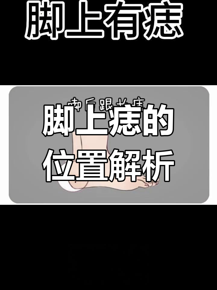 脚上有痣,位置决定命运?科学解读!