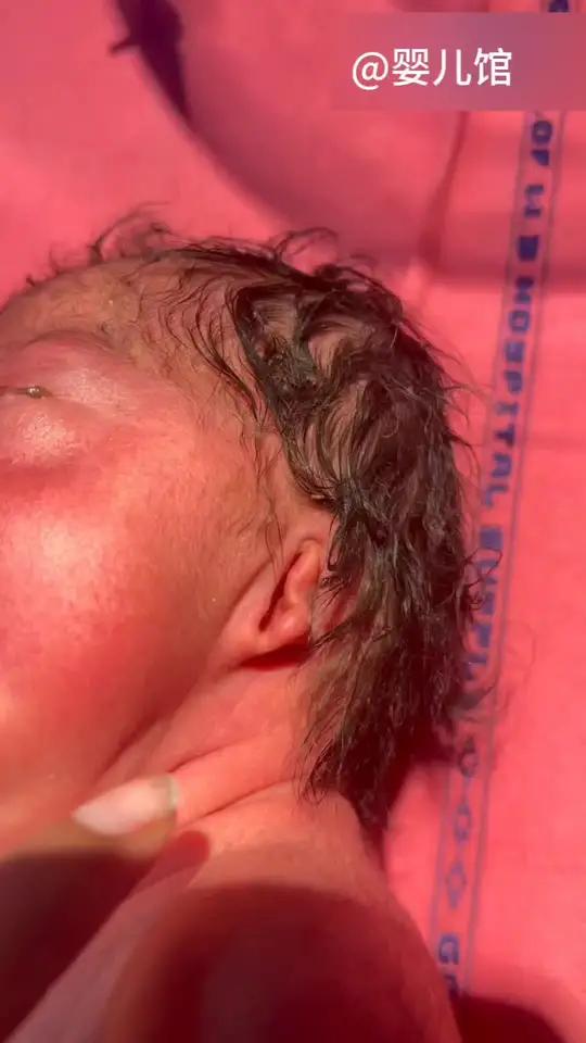 不一样的宝宝!耳朵也行有点畸形