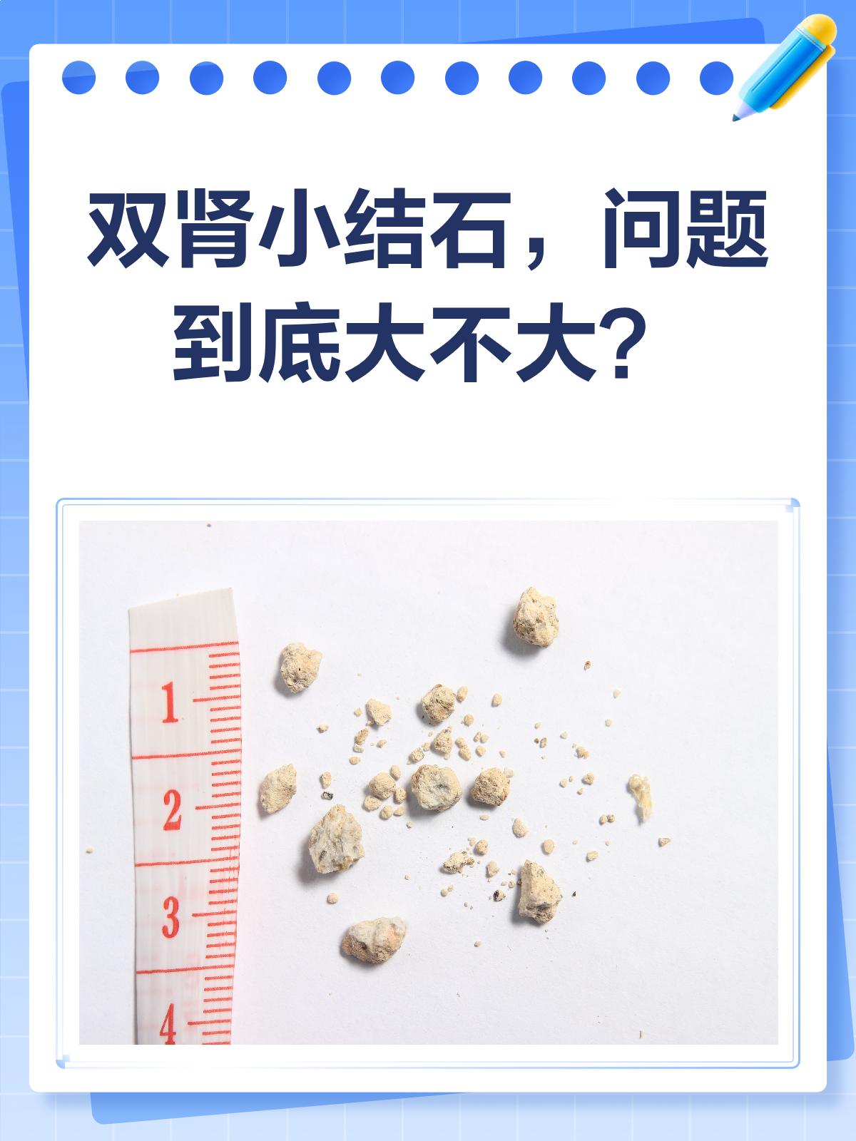 双肾小结石问题大吗 				 双肾小结石一般问题不大