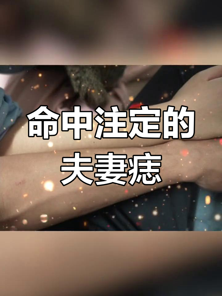 情侣痣的传说图片