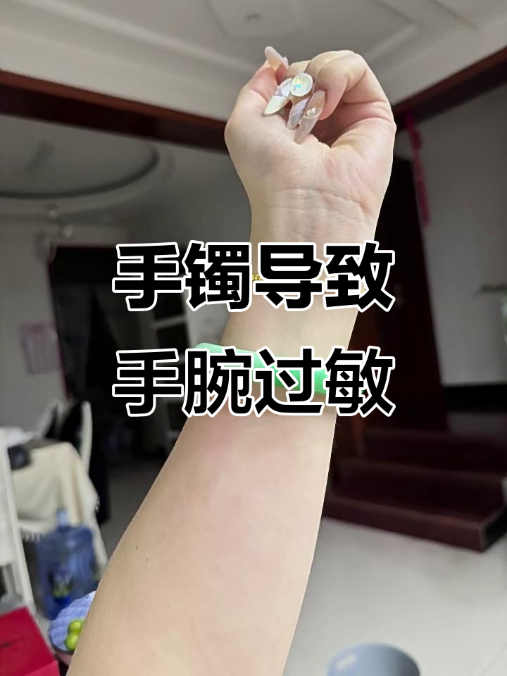 戴这个镯子手腕竟然过敏了,真让人头疼!