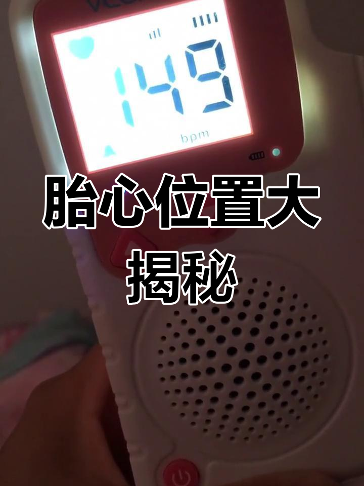 胎心的位置每次都在变,仪器一探才找到!
