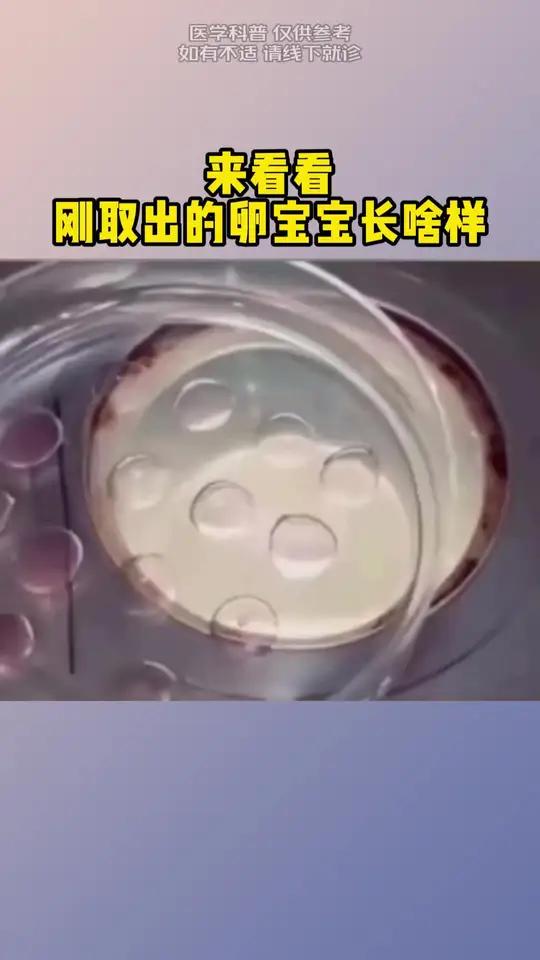 做试管取多少卵子