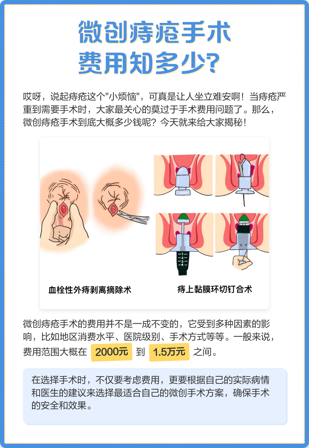 痔疮微创手术