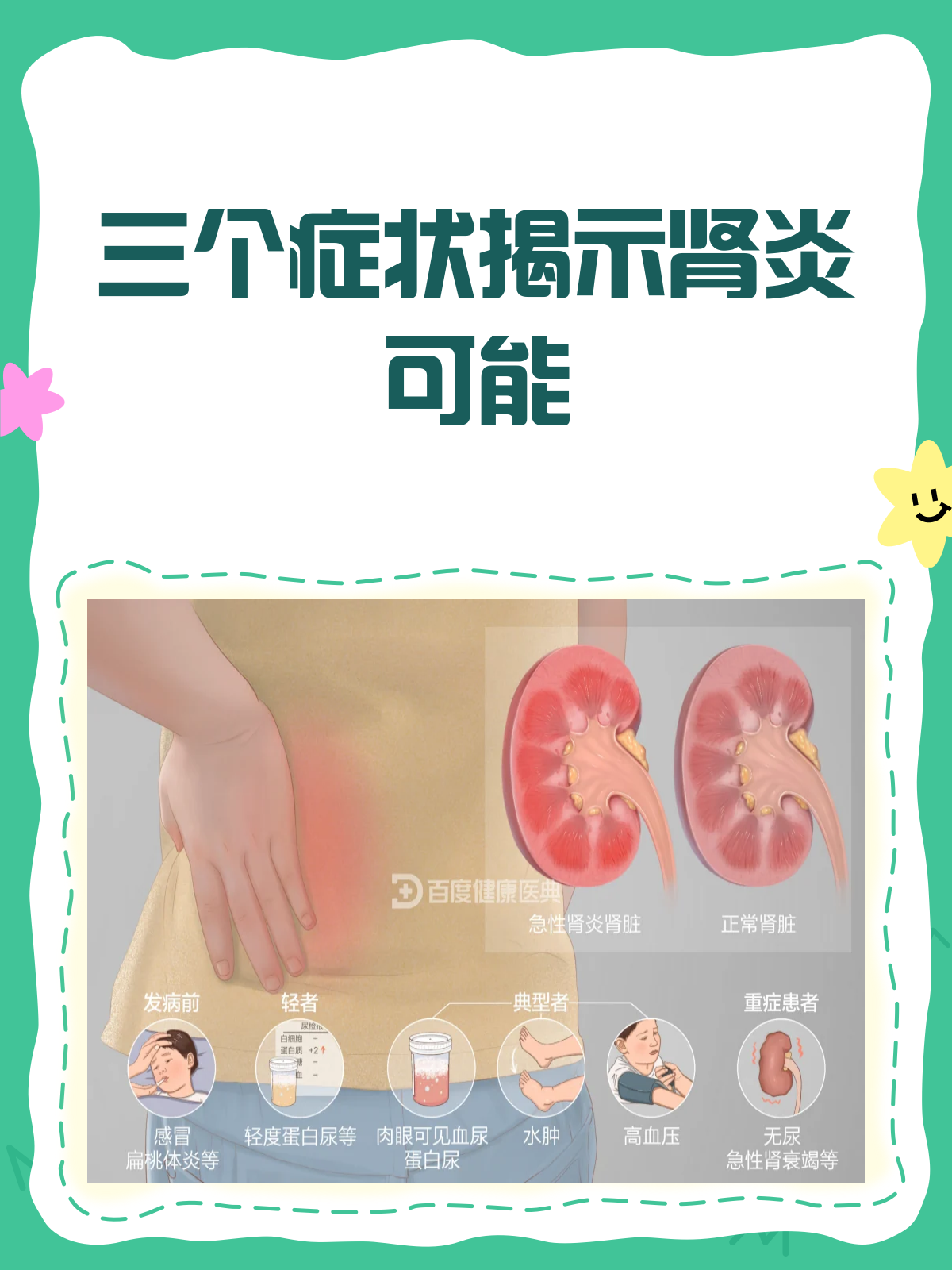 三个症状说明你可能有肾炎了!