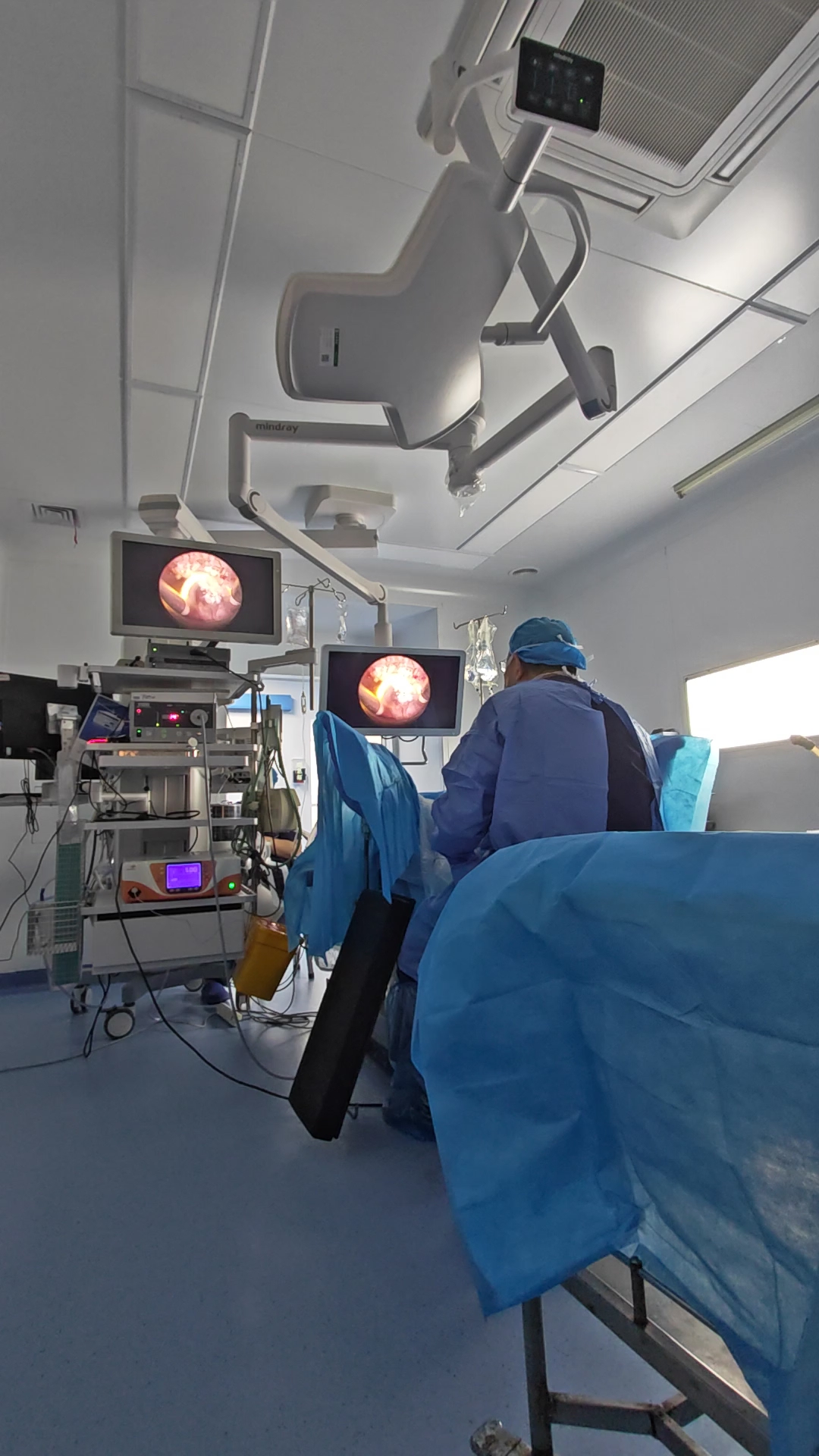 经尿道前列腺增生等离子电切手术演示