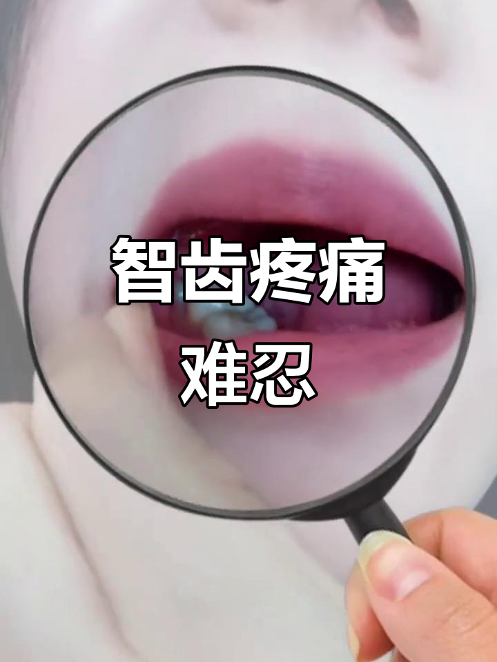 智齿作祟,腮帮子肿成包,疼得火冒三丈!忍耐是唯一选择