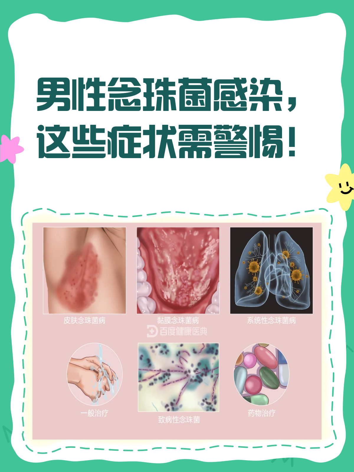 男性念珠菌感染,这些症状需警惕!