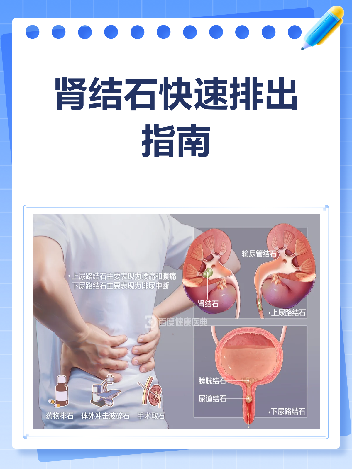 肾结石怎么排最快?这些方法帮你来搞定!