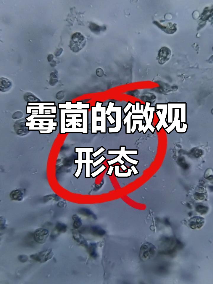 显微镜下的念珠菌世界