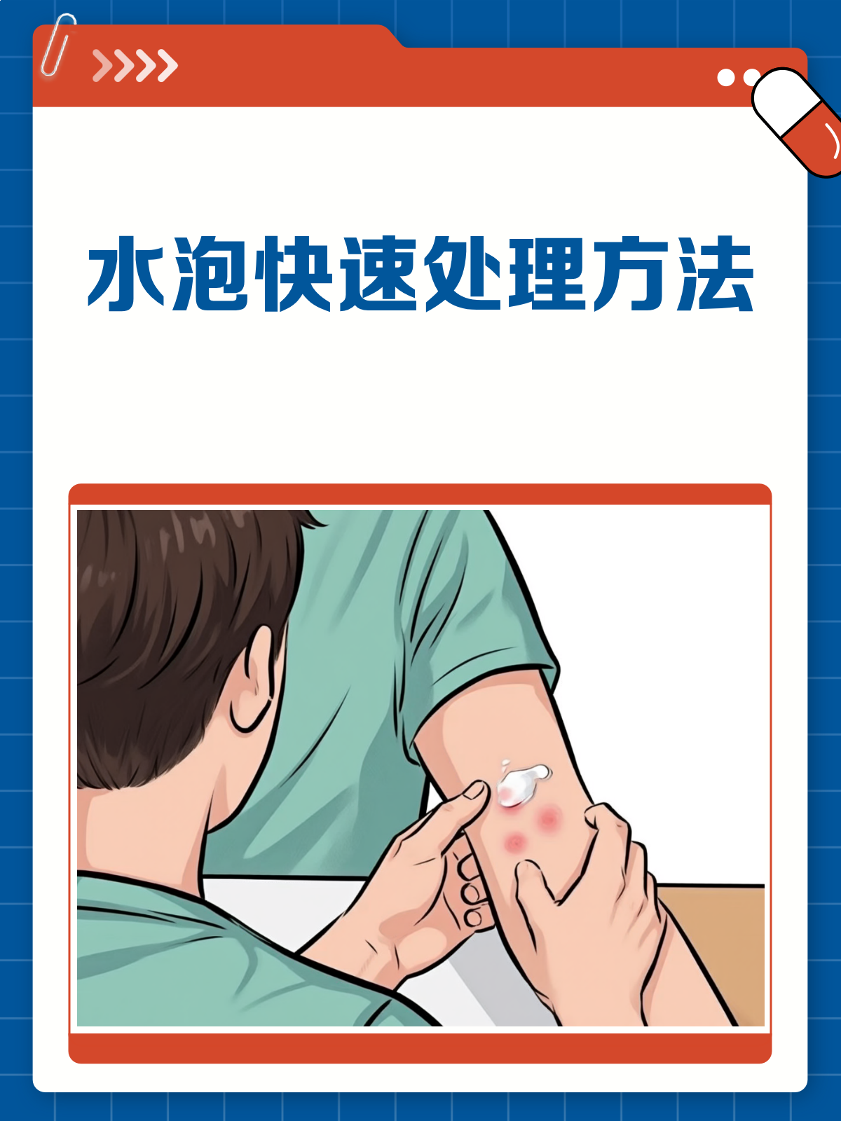 水泡烦恼别担心,这样处理快速消!