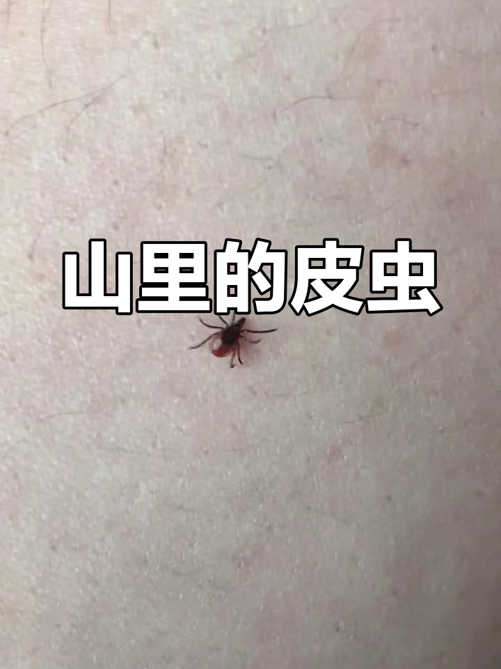 草爬子:山上的小害虫