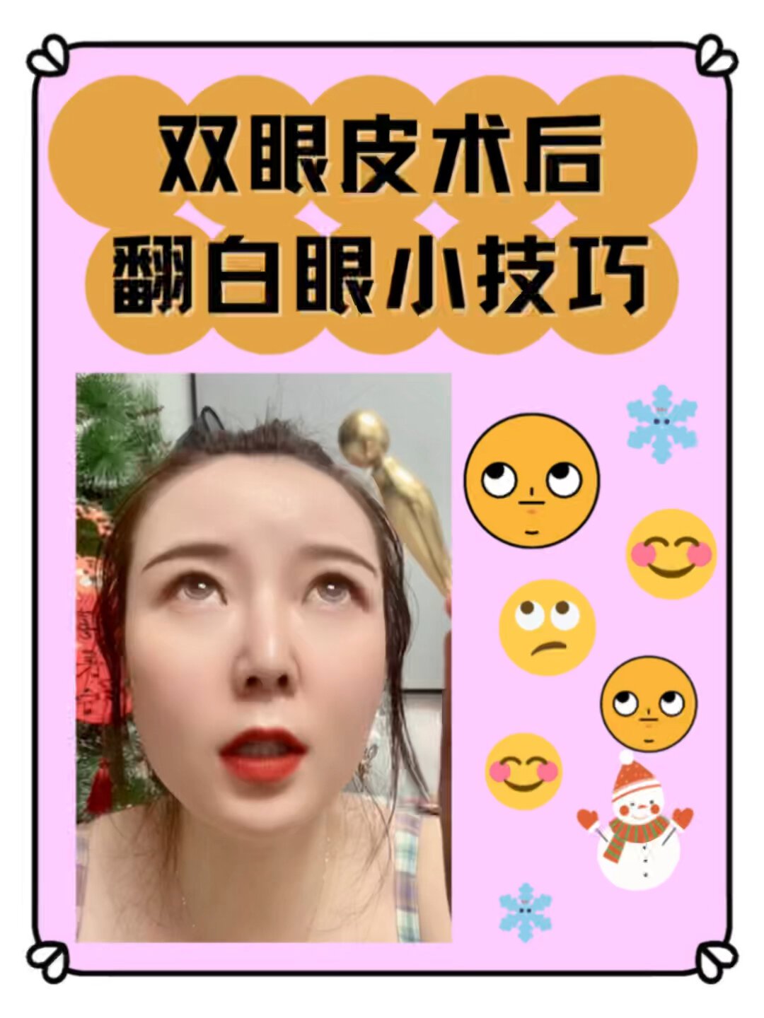 双眼皮术后翻白眼小技巧