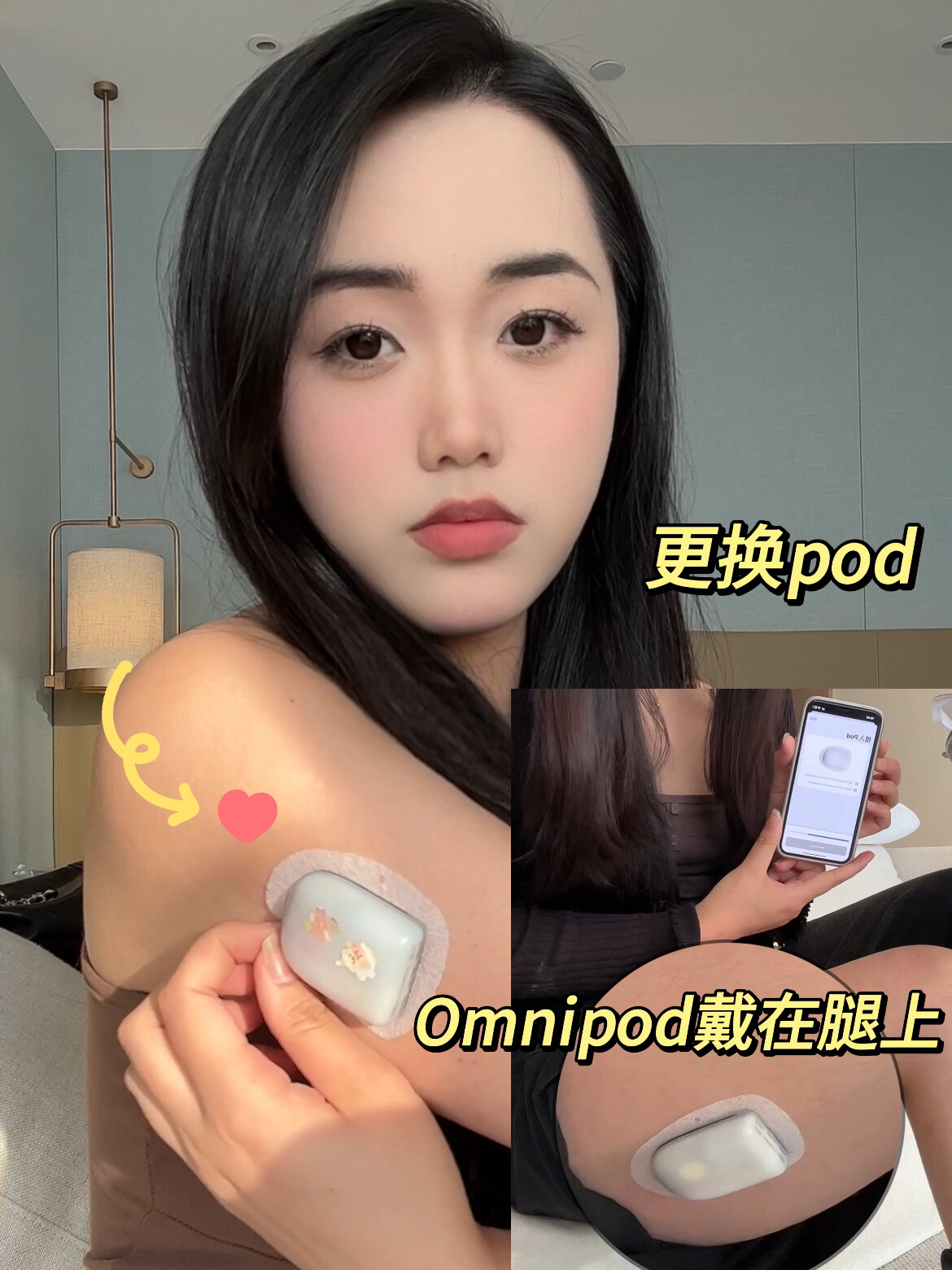 30s更换omnipod无管路胰岛素泵