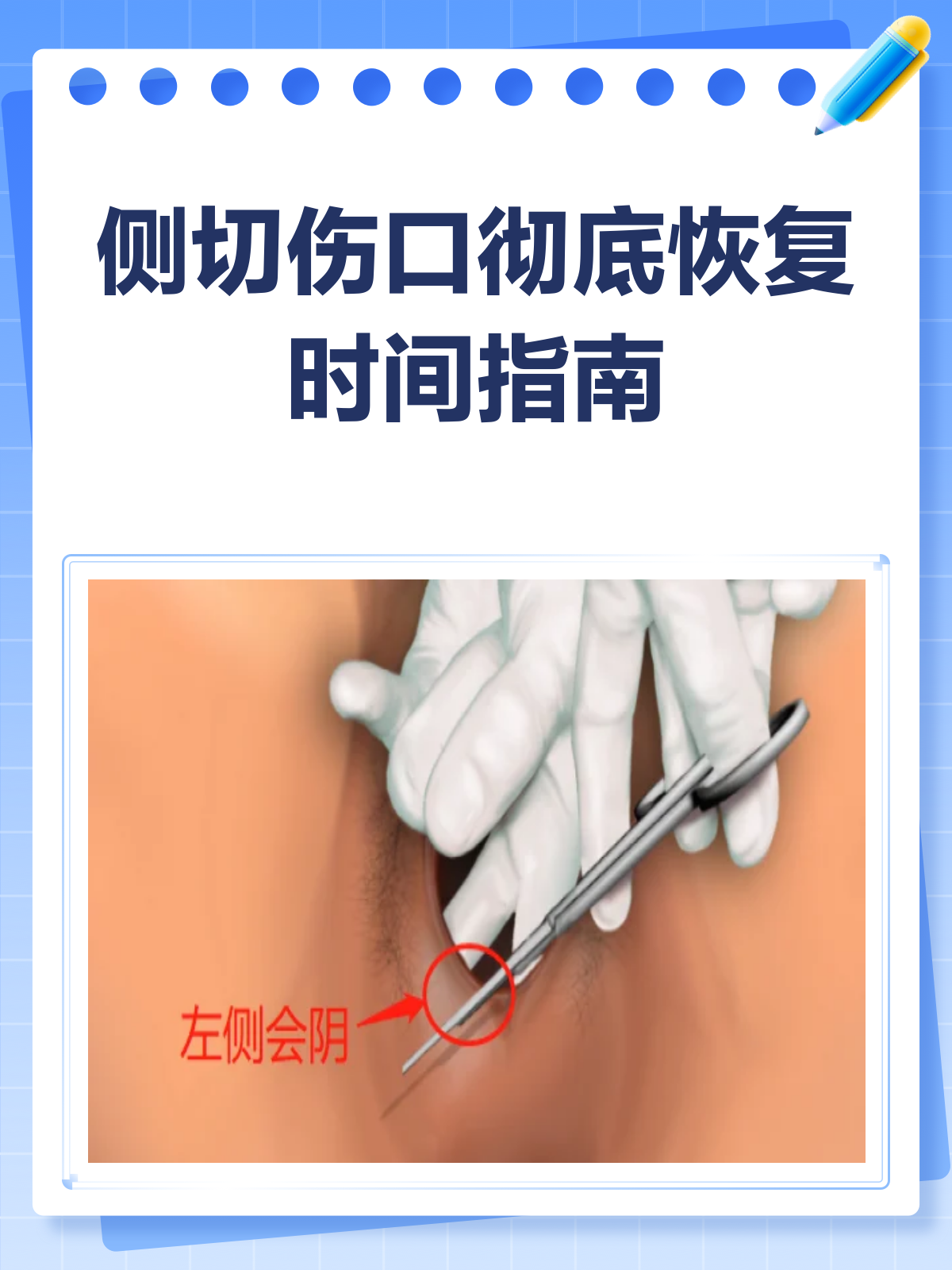 侧切伤口多久能痊愈?看这里就知道!