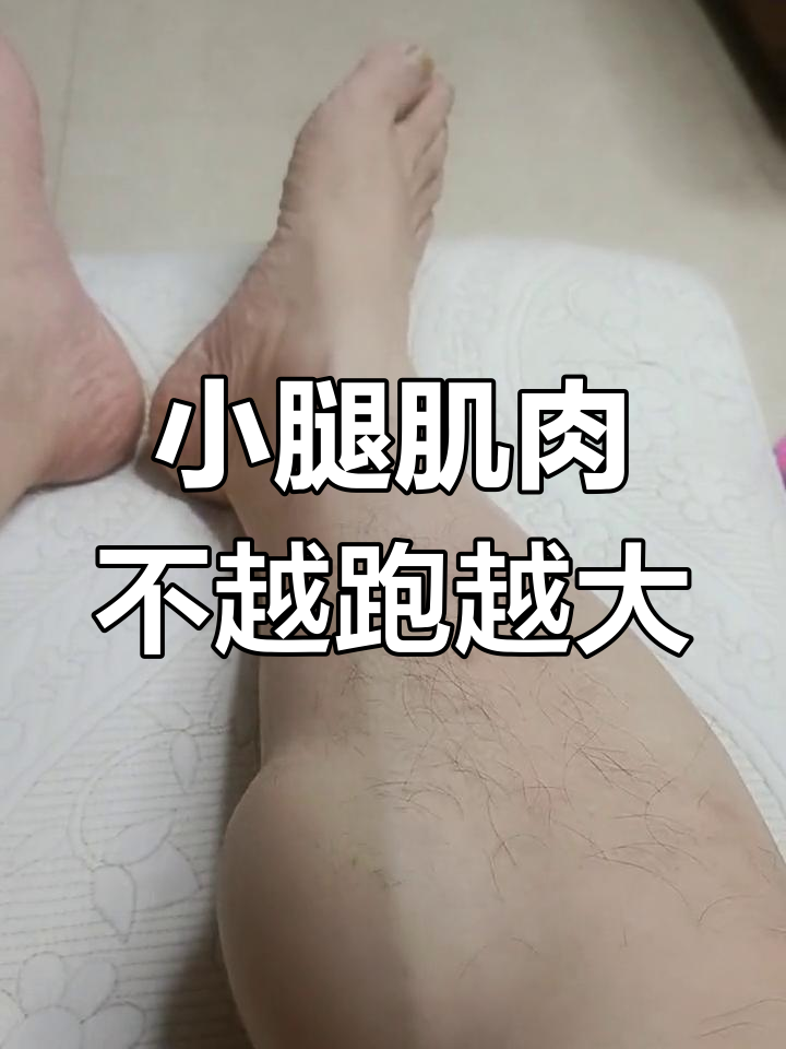 跑步不会让小腿变粗,掌握正确姿势更有效