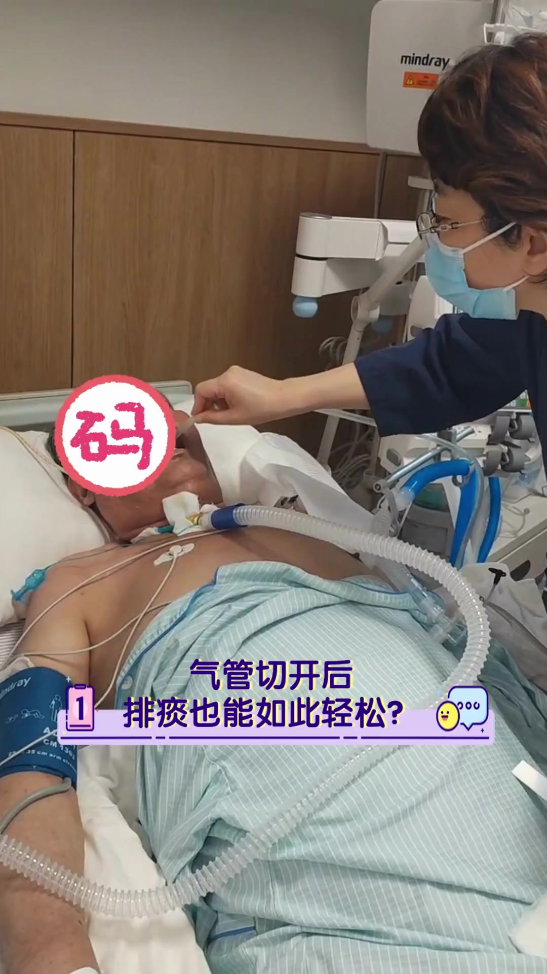 气管切开后,排痰也能如此轻松?