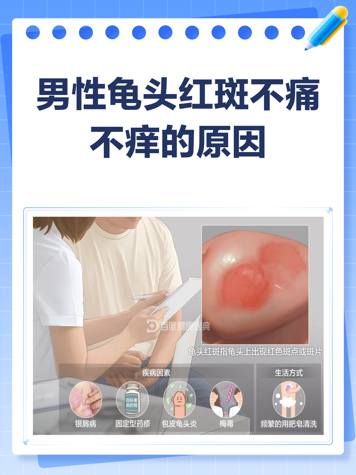 龟头红斑不痛不痒?揭秘背后四大原因!