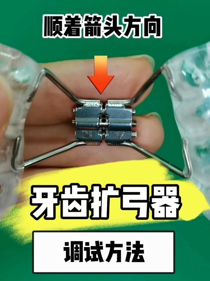 活动式/固定式扩弓器「向右r」使用说明