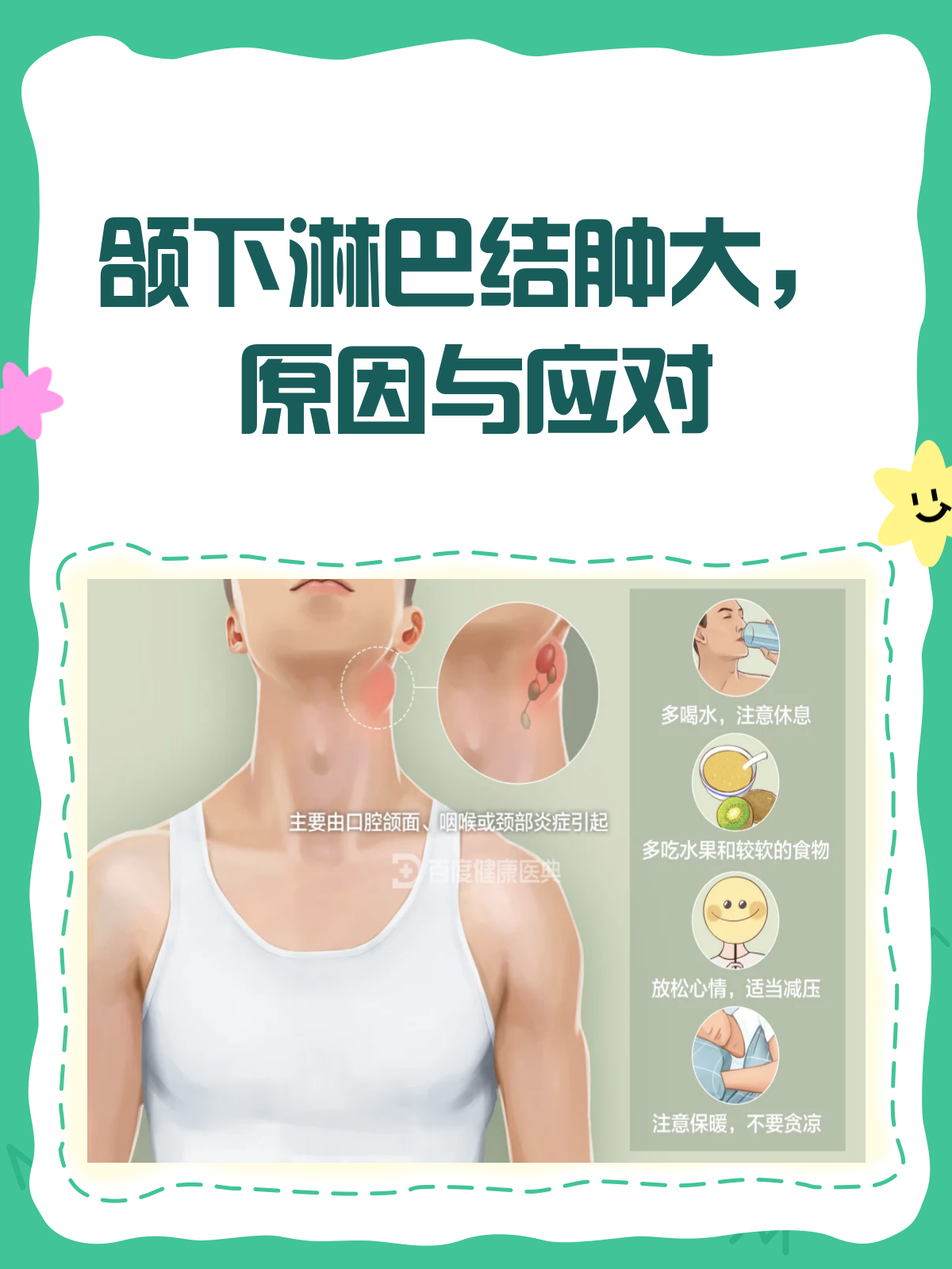 颌下淋巴结肿大怎么办?别急,看完这篇就懂了!