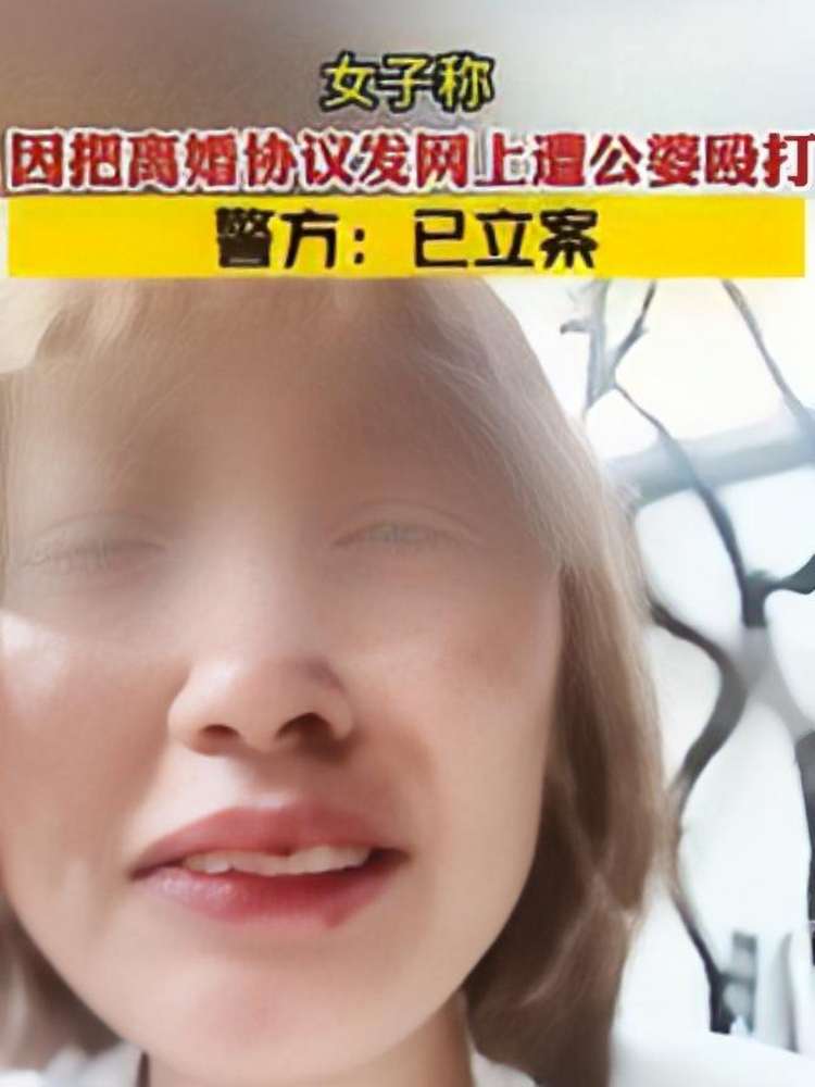 女子称因把离婚协议发网上遭公婆殴打,警方:已立案