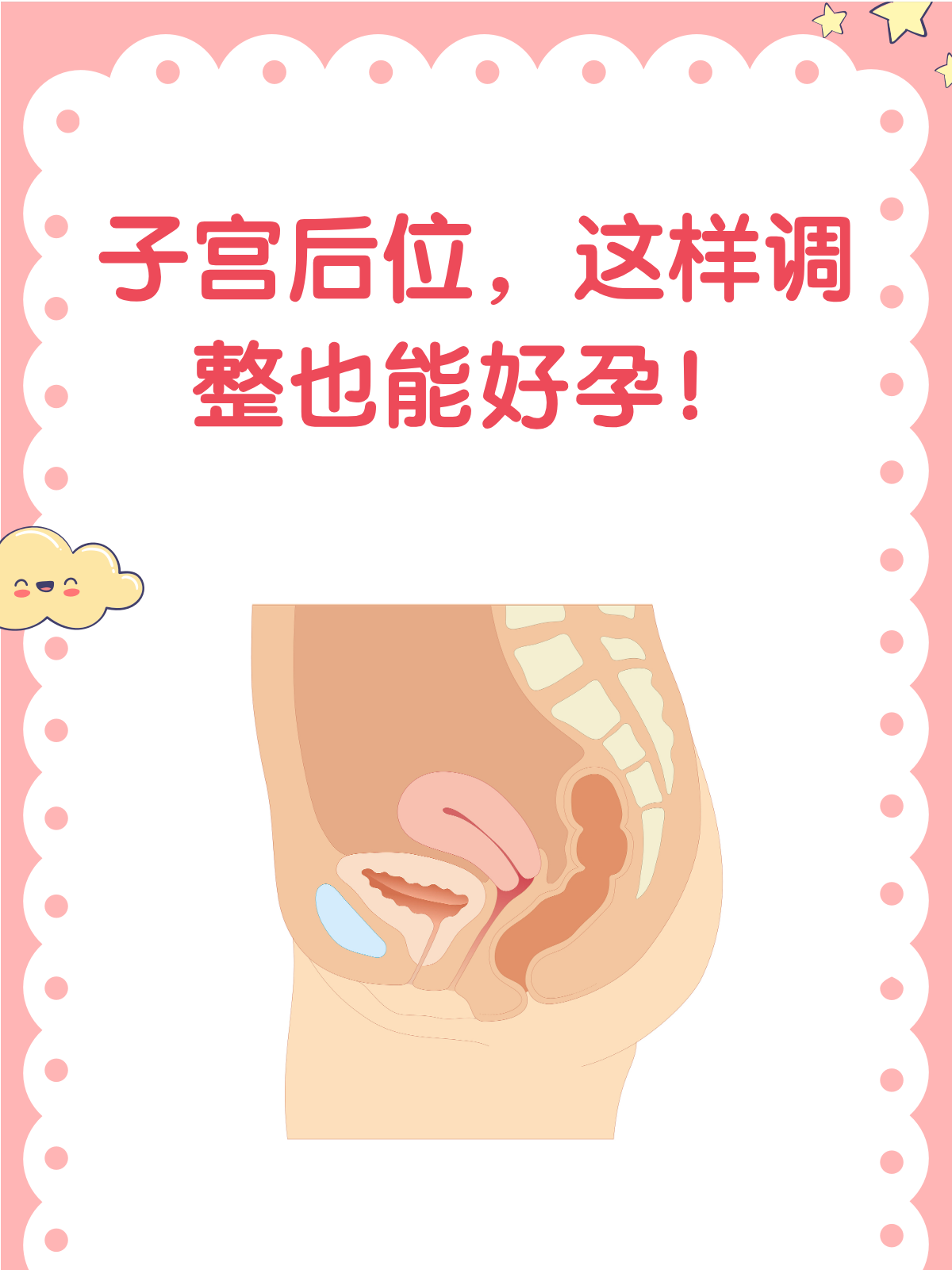 子宫后位难怀孕?别急,看完这篇就懂了!