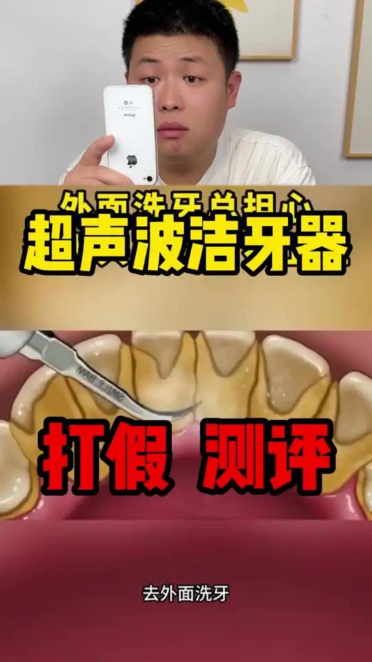 这个超声波洁牙器确实好用啊~有这方面困扰的可以试试~ 超声波洁牙器