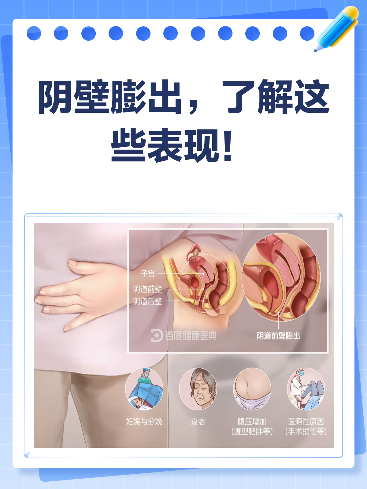 阴壁膨出知多少?一文带你搞清楚!