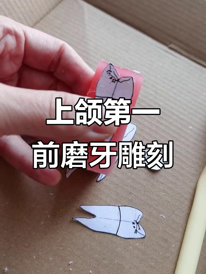 上颌第一前磨牙5