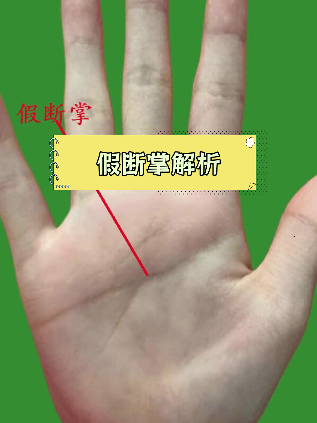 假断掌的智慧与挑战