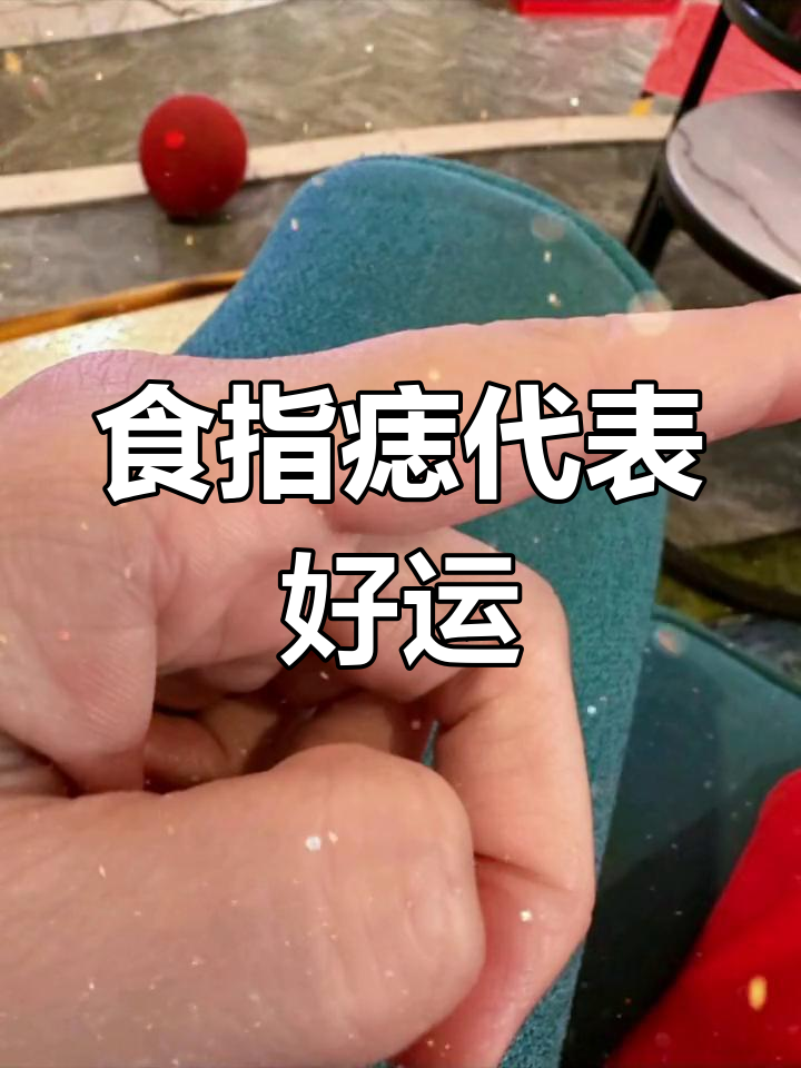 左手食指痣,运势大转