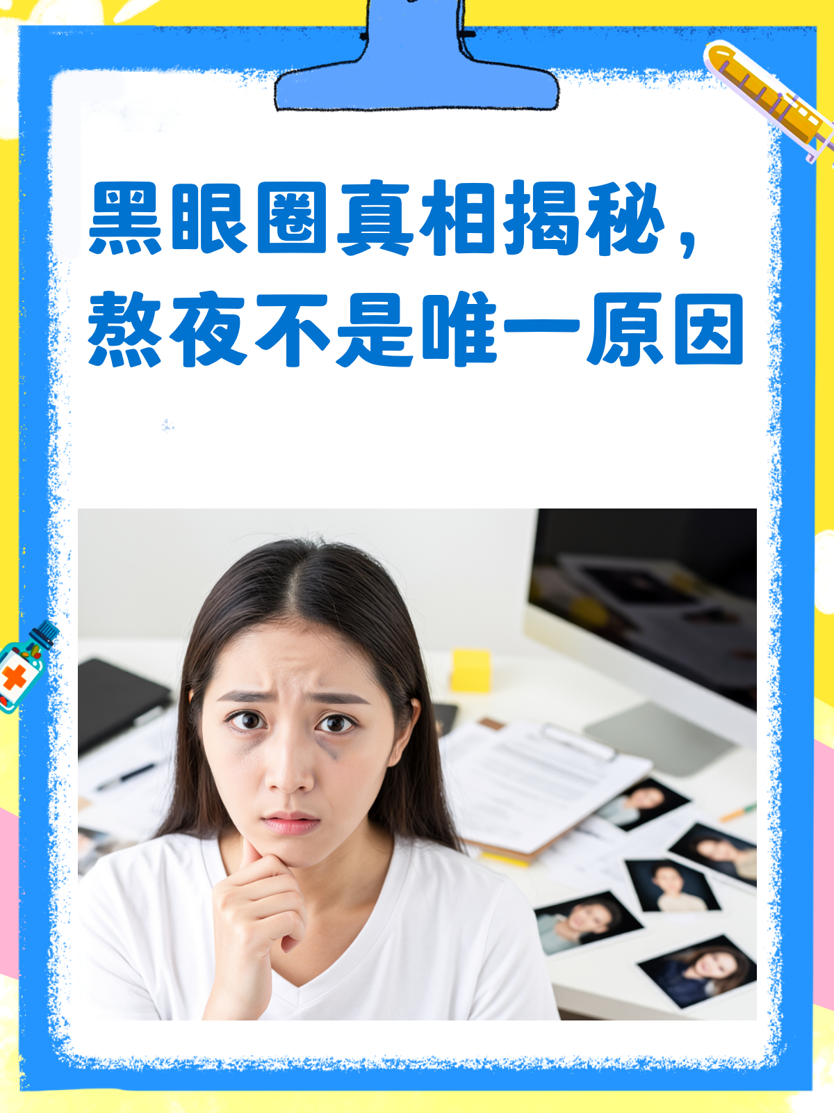 为什么熬夜会有黑眼圈