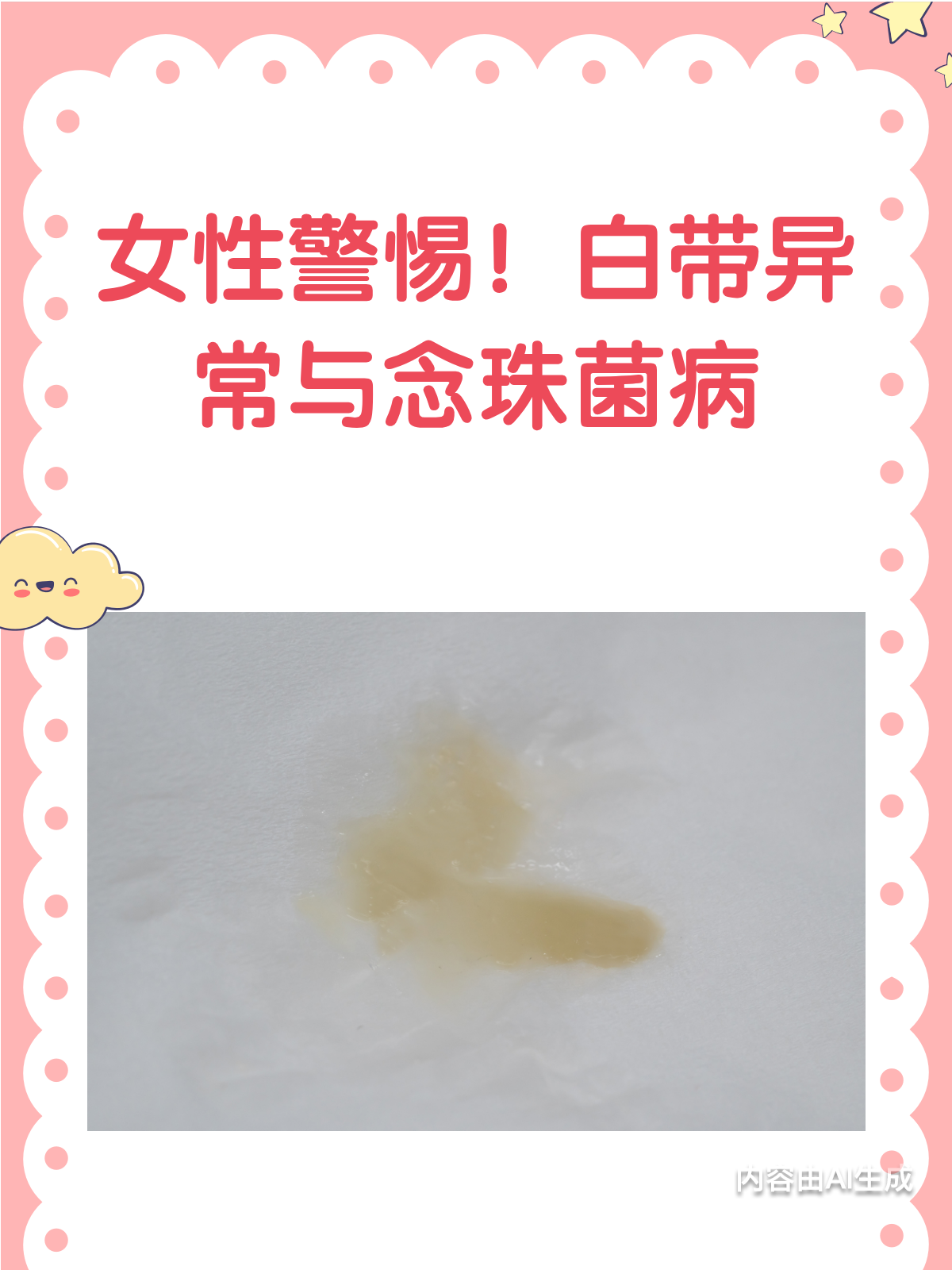 白带豆腐渣样?别急,一文读懂外阴阴道念珠菌病