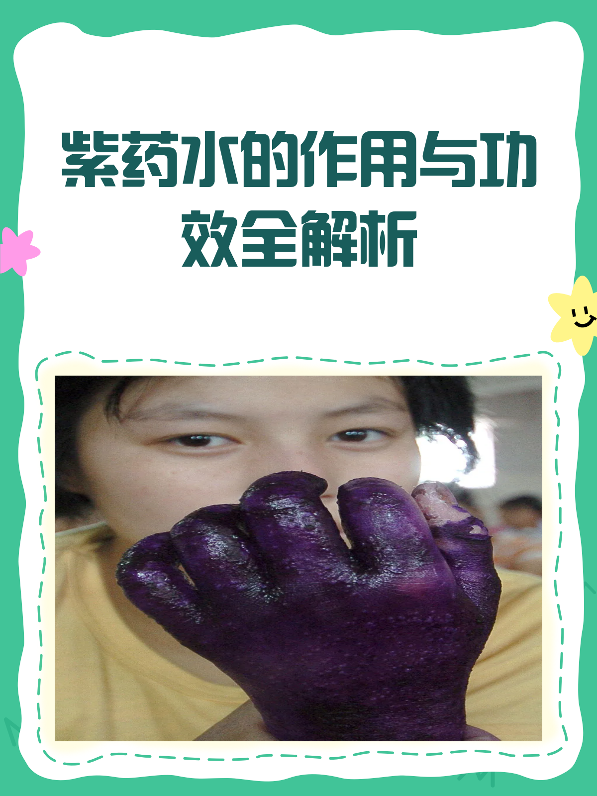紫药水怎么用?功效作用全解析!
