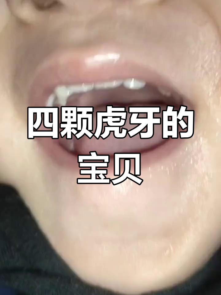 虎牙宝宝,四颗锋利,象征着力量与幸运