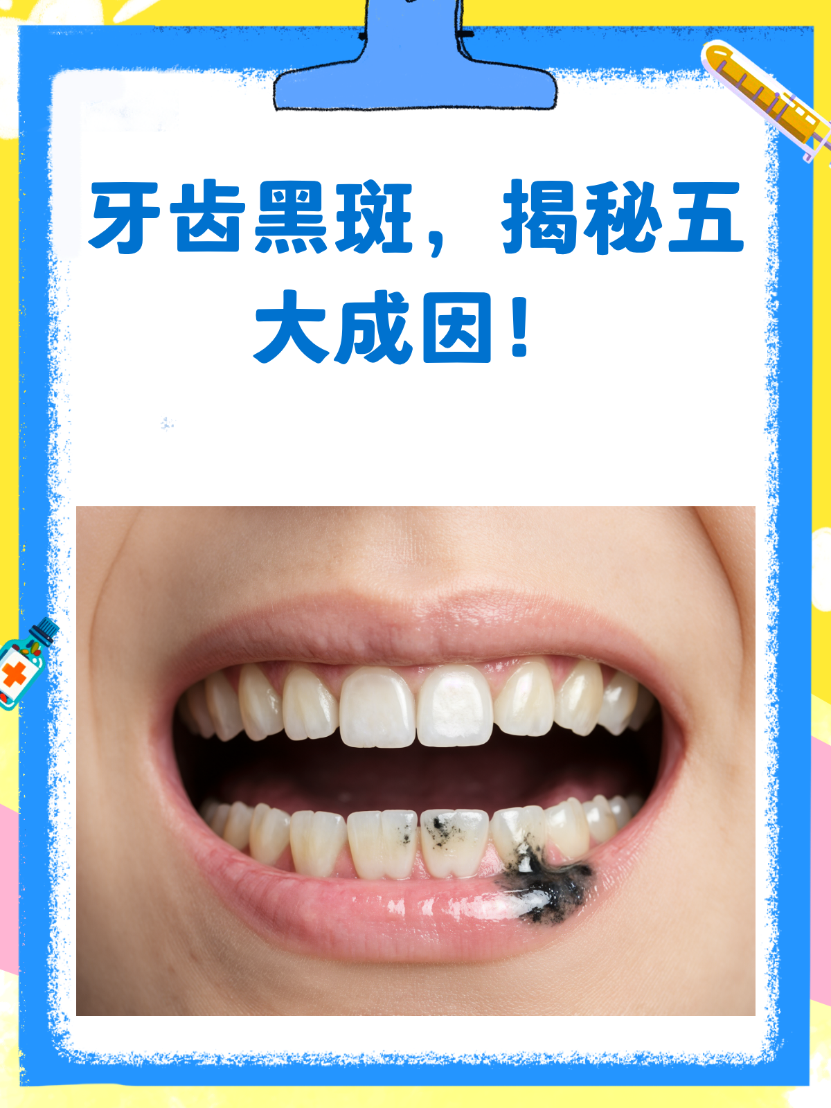 芒果表面为什么长黑斑百科在线