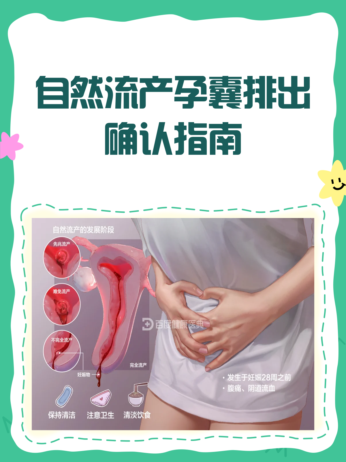 自然流产后,如何确定孕囊已排出?