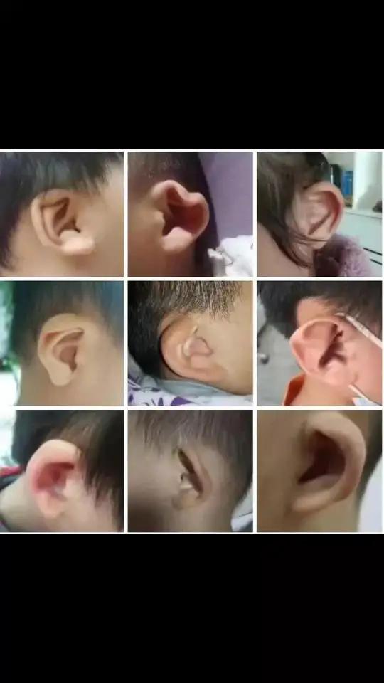 可能会说,"耳朵不好看没关系","耳朵自己会长好的","回家捋一捋,拉一