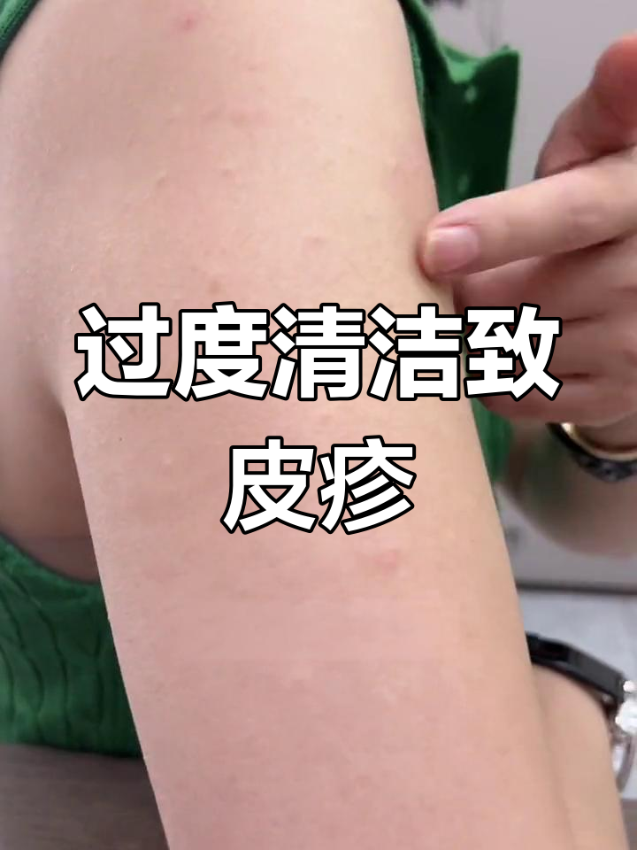 搓澡后皮肤起小疙瘩,如何避免?