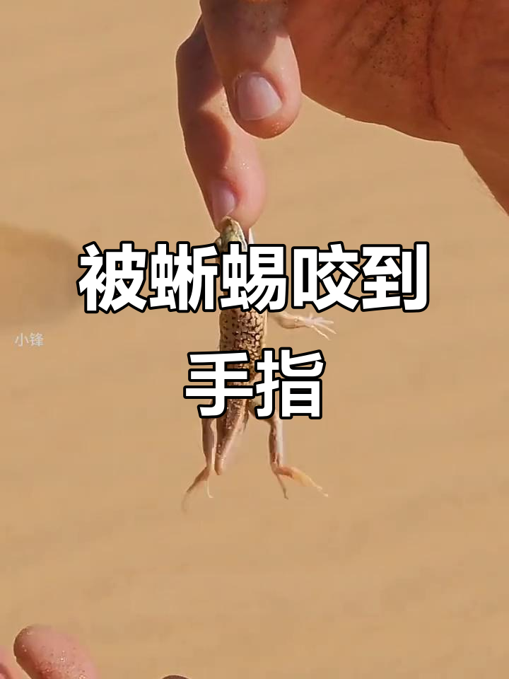 男子沙滩被蜥蜴咬手指,表情尴尬又惊悚