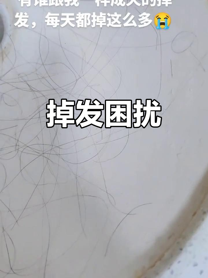 为什么头发越来越少