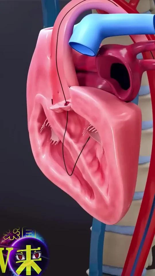 修复心脏主动脉瓣动画演示