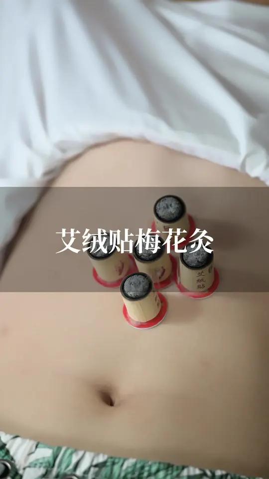 中脘梅花灸加太白,大吉大利