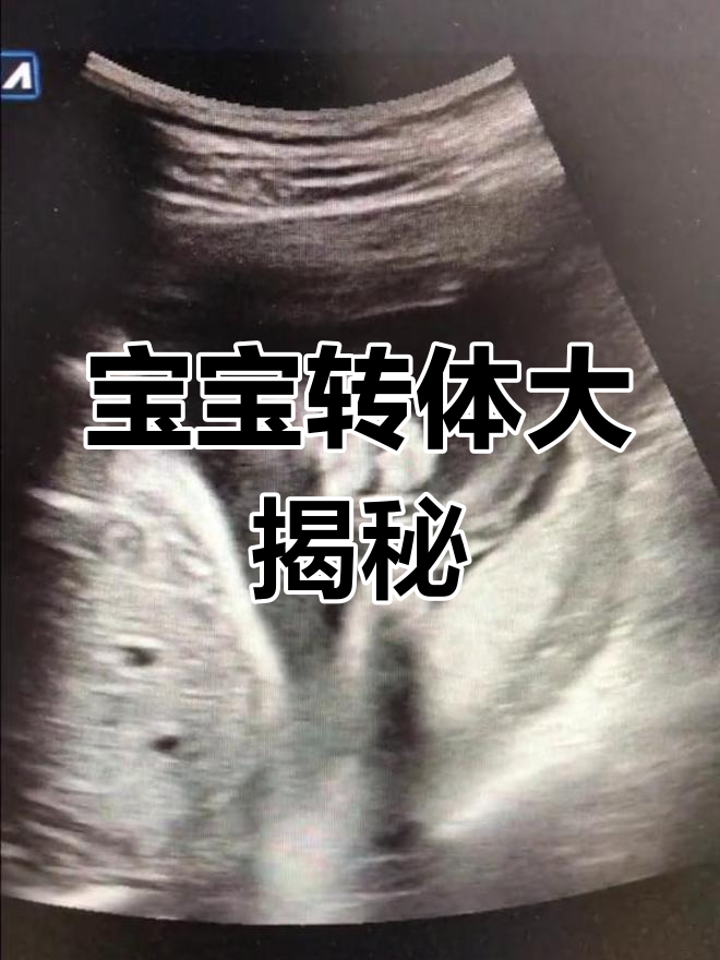 27周,宝宝从臀位转到头位,小动作萌态尽显